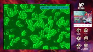 🔴Retransmisión Citofluorometría en el Diagnóstico y Seguimiento de Neoplasias Linfoides [upl. by Lrem342]