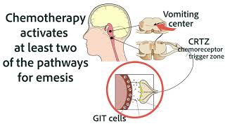 Antiemetics for Chemotherapy and GIT Origins [upl. by Karab563]