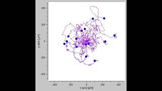 Myosin 6 in breast cancer cells – Video S1 479151 [upl. by Sander909]