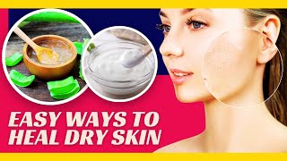 Home Remedies To Get Rid Of Dry Skin On The Face [upl. by Nerti]