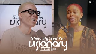 Understanding Albinism  SYV PodcastS1EP2  Ft Jessica Hyacinth [upl. by Anhcar]