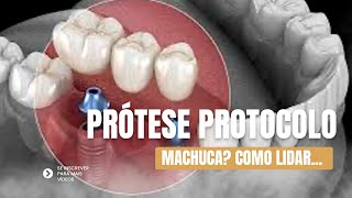 Prótese de protocolo machuca como lidar com o desconforto inicial [upl. by Atiloj64]