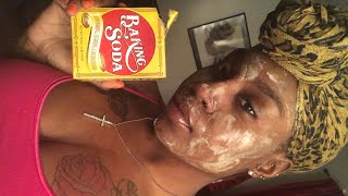 DIY Baking Soda and Honey Face Mask [upl. by Nnyleuqaj]