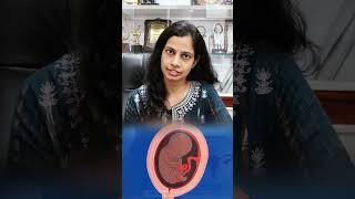 Treatment for a Molar Pregnancy  Dr Nisha Mangal Explains  Molar Pregnancy [upl. by Boorman576]