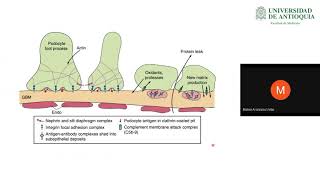 Nefropatía Membranosa y Glomerulonefritis Membrano Proliferativa  Dr Mateo Aranzazu [upl. by Hamlani809]