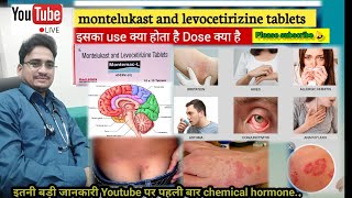 montelukast levocetirizine  सर्दी जुखाम खांसी एलर्जी के लिए रामबाण दवाएं [upl. by Nydia]