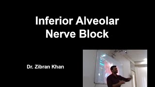 Inferior Alveolar Nerve Block [upl. by Nolyat38]