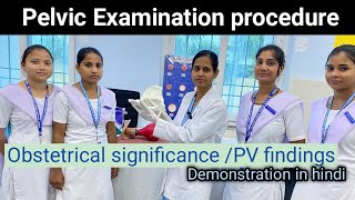 Pelvic Examination procedure Obstetrical significance  PV findings Pelvic Demonstration [upl. by Nnylaj146]