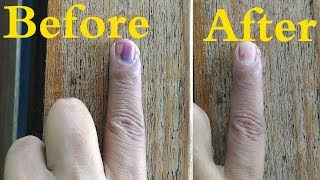 removing indelible ink  voting ink  tips for indelible ink [upl. by Inaflahk330]