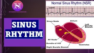 NORMAL SINUS RHYTHM EKG ECG INTERPRETATION [upl. by Levina]