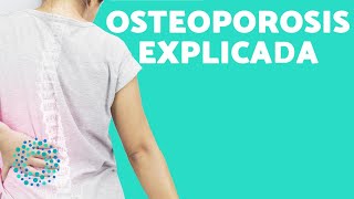 Qué es la OSTEOPOROSIS 🦴 Síntomas y causas de la OSTEOPOROSIS [upl. by Adanar]