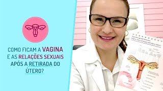 As relações sexuais após a histerectomia [upl. by Eelannej]