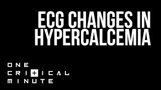 ECG changes in Hypercalcemia  One Critical Minute 1CM [upl. by Guadalupe346]