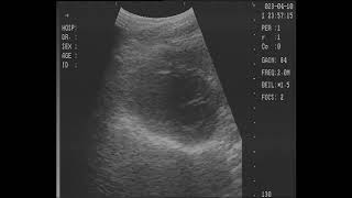 Ultrasound  Long Resting Heartbeat [upl. by Meesak]