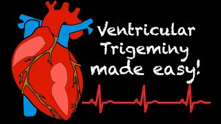 EMS Cardiology  Tachy Tuesday Ventricular Trigeminy [upl. by Finah]