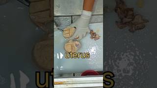 Uterus specimen grossing endometrial tissue 😔 [upl. by Laekim973]