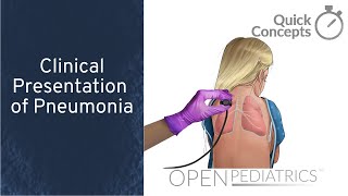 Clinical Presentation of Pneumonia by B Fissel and P Stoeck  OPENPediatrics [upl. by Mutua]