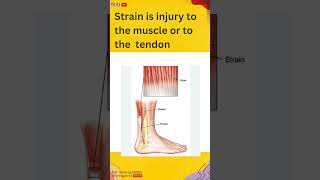 Sprain and Strain  medical surgical nursing  explained with image shorts SprainvsStrain [upl. by Luapnaes976]