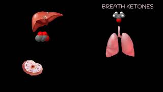 Ketogenesis Energy Needs Increase [upl. by Haslett]