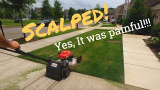 Scalped My Lawn Yes it was Painful [upl. by Yasui]