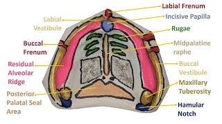 شرح Anatomical landmarks In Maxilla على Study cast [upl. by Ennad]