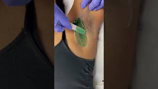 Professional underarm video waxing waxingexpert [upl. by Haiasi952]