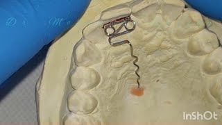 Orthodontic Wire Bending Z Spring [upl. by Nagram748]