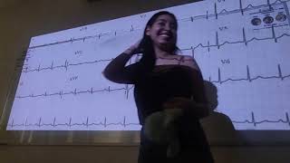 Clase 21  Interpretación de electrocardiograma Parte II [upl. by Jacobson]