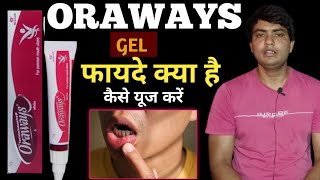 oraways gel uses in hindi  oraways kaise use kare  oraways gel  oraways mouth ulcer gel [upl. by Mashe]