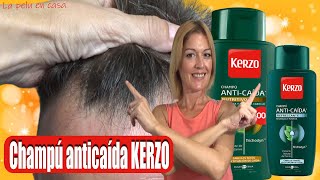 Tratamiento para la Caída del Cabello Graso  Cómo Frenar la Caída del Cabello  Champú menta KERZO [upl. by Nner]