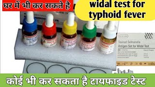 widal test in hindi  widal test  widal test kaise kiya jata hai  typhoid test kaise kiya jata hai [upl. by Valentino758]