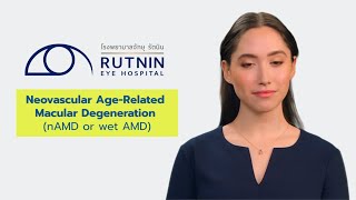 The Pathophysiology of Wet AMD  Degeneración macular humeda [upl. by Odama142]