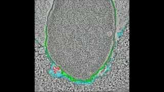 Identification and Characterization of Anaplasma phagocytophilum Proteins Involved in Infection [upl. by Victoir677]