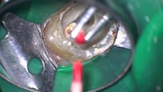 Squirt obturation of an upper molar with joining root canals [upl. by Adlar]