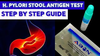 Helicobacter pylori Stool Antigen Test MEDICAL LABORATORY SCIENCE [upl. by Letnuahs]