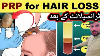 PRP Hair treatment again naya pakistan Khuram Abbas [upl. by Eidna]