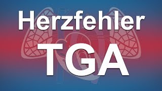 Herzfehler einfach erklärt Transposition der großen Arterien TGA [upl. by Amelie]