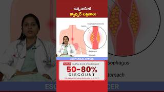 Esophageal Cancer Symptoms in 30 Sec l Dr Jyothi Jonnadula shorts MedPlusONETV [upl. by Steinke]