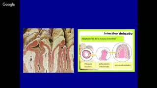 Galactosemia Fisiopatología diagnóstico y tratamiento [upl. by Yawnoc]