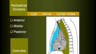 Radiology of Mediastinal lesions in Arabic [upl. by Sitoeht]