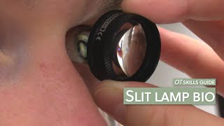 OT skills guide Slit lamp bio [upl. by Assirehs]