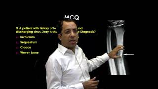 eQ Recent Exam Question Radiology  Sequestrum [upl. by Rocker]