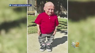 Actor Verne Troyer Dead At 49 [upl. by Rimidalv802]