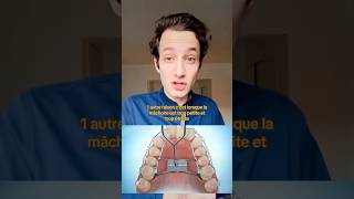 POURQUOI LE DISJONCTEUR AVANT LES BAGUES  🦷👨‍⚕️ dentiste orthodontie appareildentaire [upl. by Nodanrb]