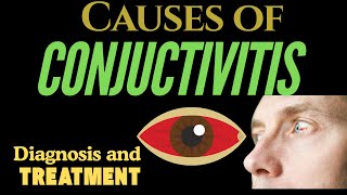 Understanding Conjunctivitis Causes Symptoms and Treatments [upl. by Ykroc321]