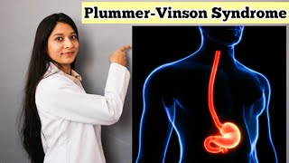 PlummerVinson Syndrome in Hindi  Detail Explanation With Notes  Causes Symptoms Treatment [upl. by Ainoyek155]