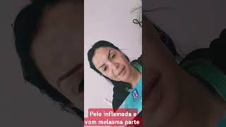 PELE INFLAMADA amp COM MELASMA  TAMPAR A PELE [upl. by Qahsi946]