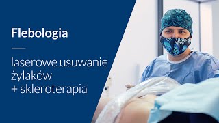 Laserowe zamknięcie żył i skleroterapia hybrydowe leczenie żylaków [upl. by Clarine]