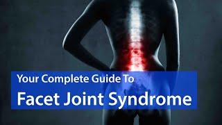 Is Facet Joint Syndrome Causing Your Back Pain EVERYTHING YOU SHOULD KNOW [upl. by Vincelette]