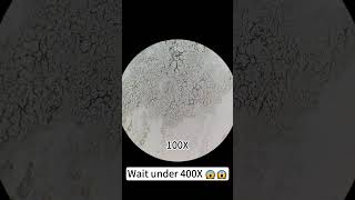 Pimples at 400X magnification are really cool underthemicroscope beefcut scienceshorts [upl. by Atiuqad]